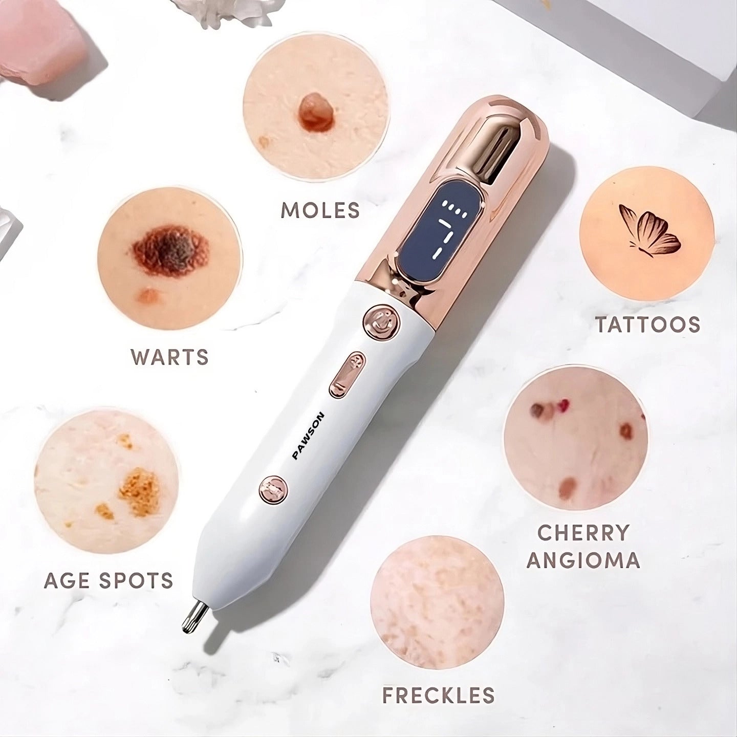 Pawson Plasma Pen
